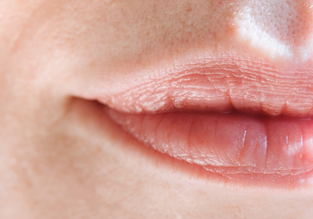 Nahaufnahme eines Gesichts, zu sehen ist nur ein Teil der Lippen.
