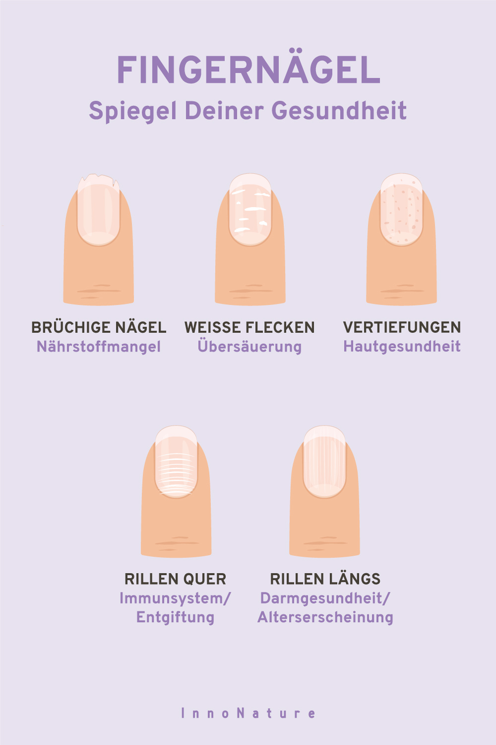 Bild von unterschiedlichen Fingernägeln und deren Bedeutung