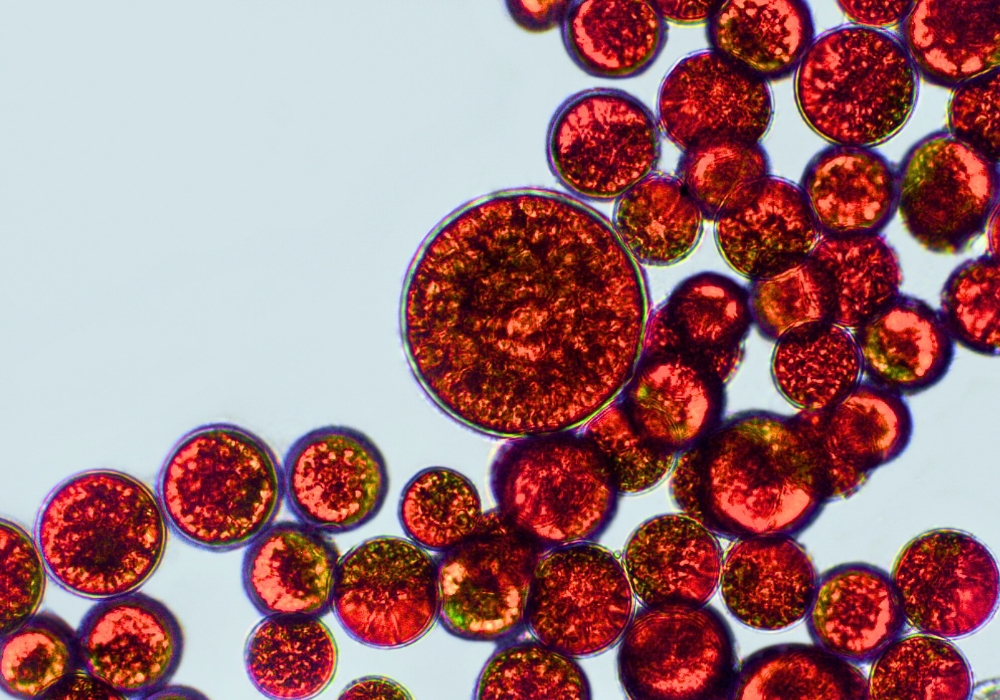 Mikroalge Haematococcus pluvialis unter Mikroskop