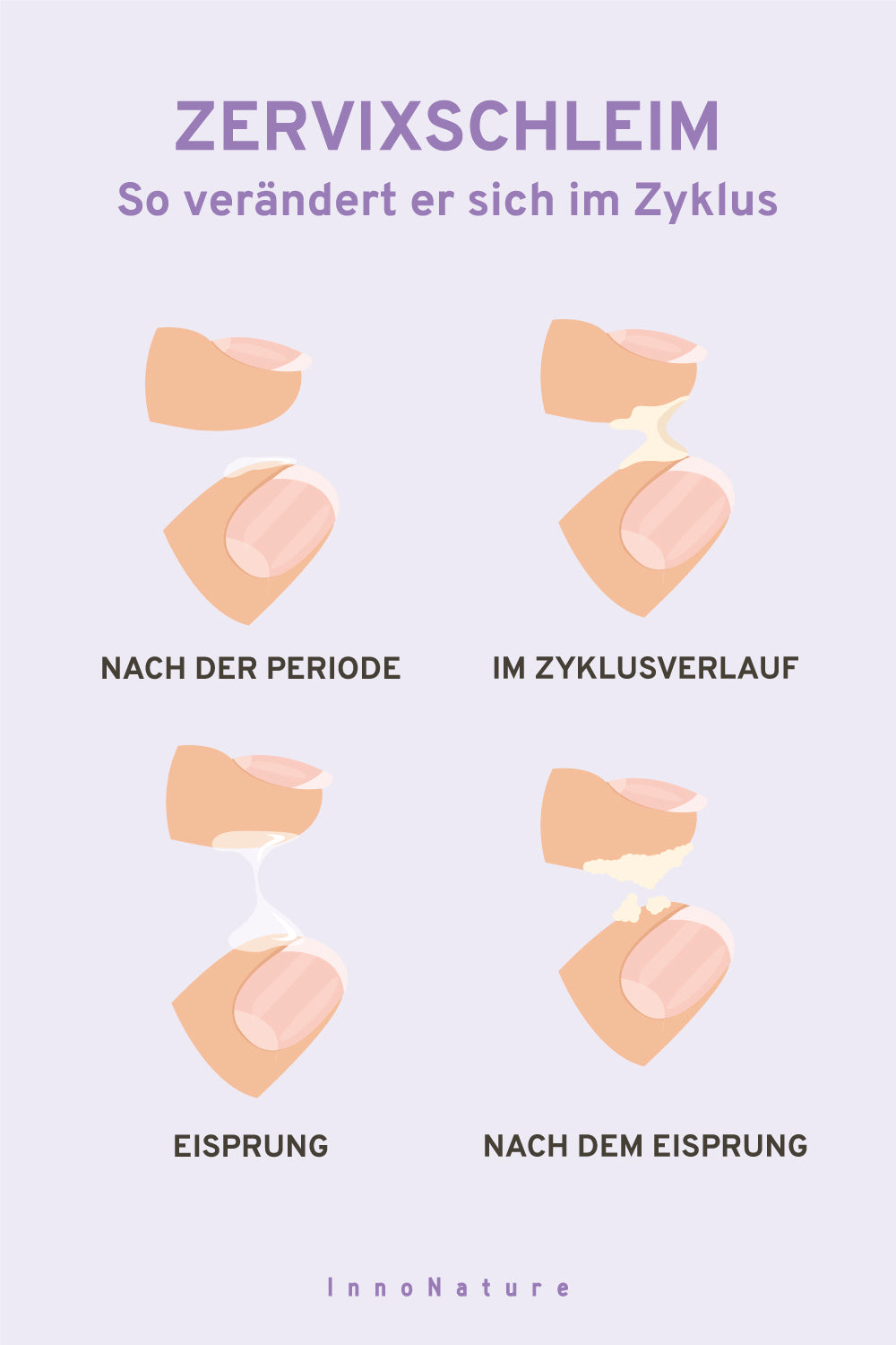 Informationsgrafik mit Zervixschleim in unterschiedlichen Stadien